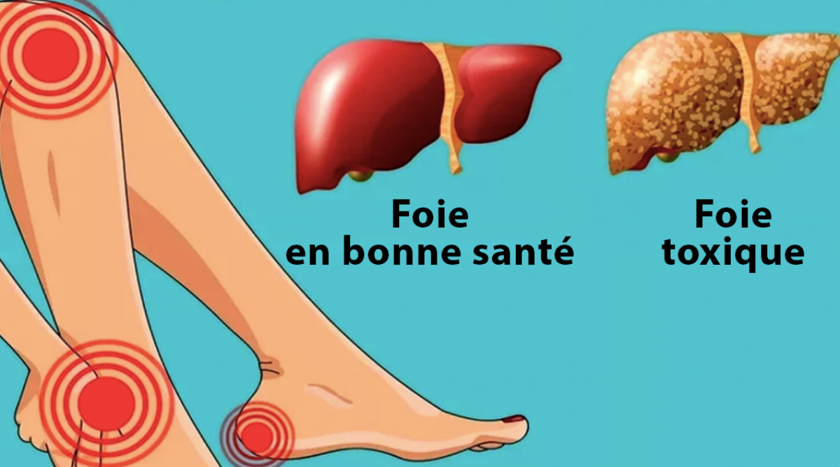 Votre foie est probablement plein de toxines, voici comment le nettoyer avec une recette au citron