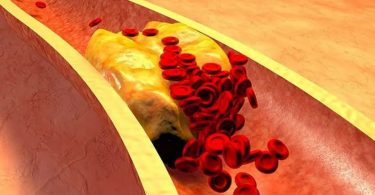 Ce qu’on ne vous dit pas sur le cholestérol